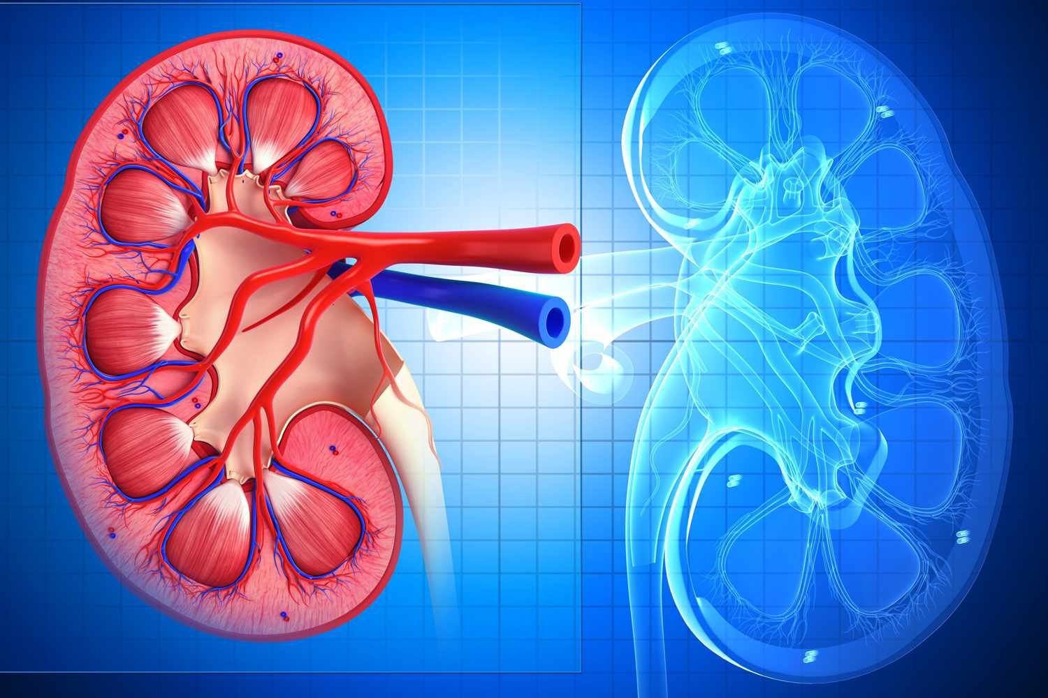 Renal failure treatment Nagpur