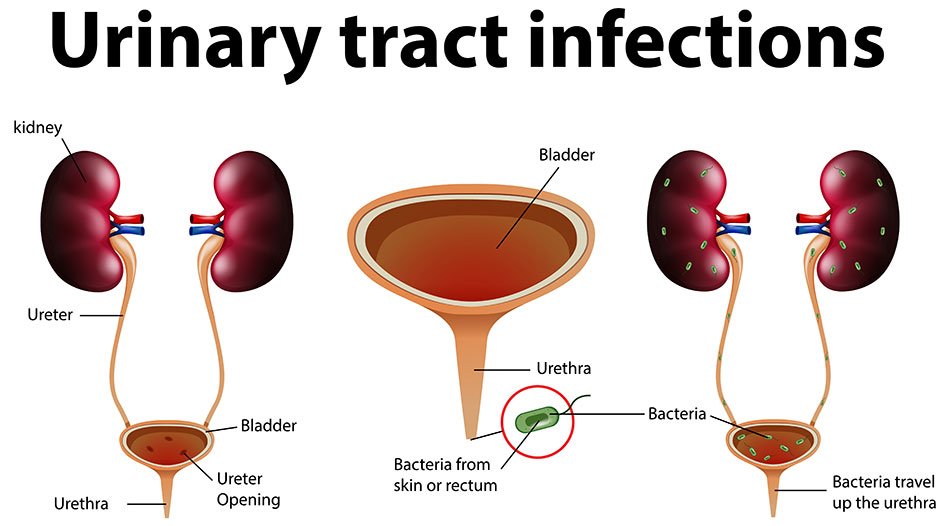 Urine infection specialist in Nagpur